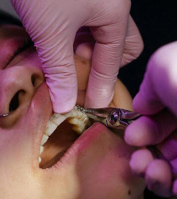 clinica dental melitoni